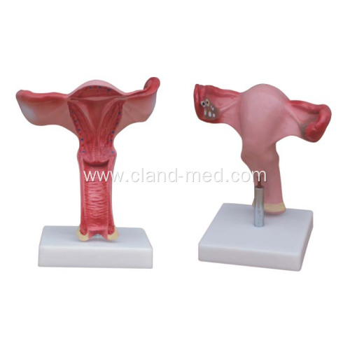 MAGNIFIED UTERUS MODEL